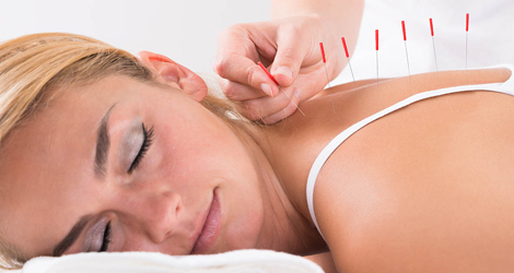 Acupuncture-Treatment
