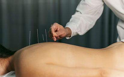 Discover the Healing Potential of Acupuncture Treatment at Sandalwood Physiotherapy